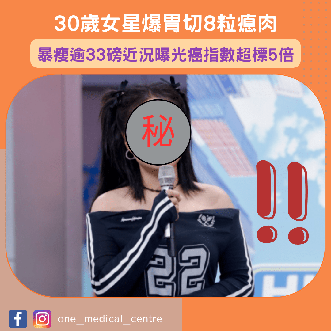 【30歲女星爆胃切8粒瘜肉　暴瘦逾33磅近況曝光癌指數超標5倍】